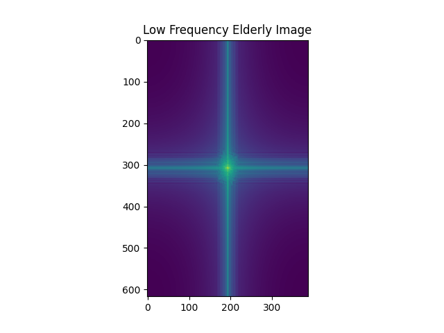 Fourier Transform of Low Frequency Elderly