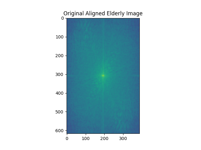 Fourier Transform of Elderly